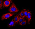 SDHA Antibody in Immunocytochemistry (ICC/IF)