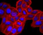 CD138 Antibody in Immunocytochemistry (ICC/IF)