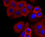 CD138 Antibody in Immunocytochemistry (ICC/IF)