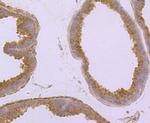 CD138 Antibody in Immunohistochemistry (Paraffin) (IHC (P))