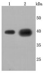 Cathepsin H/K/L/V Antibody in Western Blot (WB)