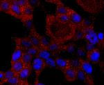 CYP2E1 Antibody in Immunocytochemistry (ICC/IF)