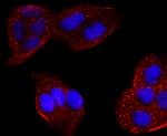 CYP2E1 Antibody in Immunocytochemistry (ICC/IF)