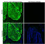 CD104 (Integrin beta 4) Antibody in Immunohistochemistry (Paraffin) (IHC (P))