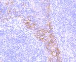 CD104 (Integrin beta 4) Antibody in Immunohistochemistry (Paraffin) (IHC (P))