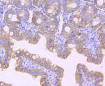 CD104 (Integrin beta 4) Antibody in Immunohistochemistry (Paraffin) (IHC (P))