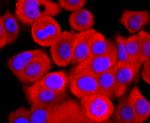 ATP5A1 Antibody in Immunocytochemistry (ICC/IF)