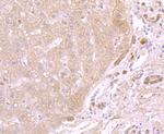 ATP5A1 Antibody in Immunohistochemistry (Paraffin) (IHC (P))