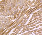 ATP5A1 Antibody in Immunohistochemistry (Paraffin) (IHC (P))