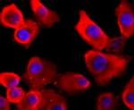 VCP Antibody in Immunocytochemistry (ICC/IF)