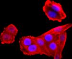 VCP Antibody in Immunocytochemistry (ICC/IF)