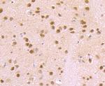 VCP Antibody in Immunohistochemistry (Paraffin) (IHC (P))