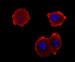 NEFM Antibody in Immunocytochemistry (ICC/IF)