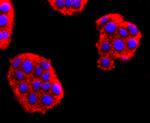 NEFM Antibody in Immunocytochemistry (ICC/IF)