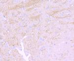 NEFM Antibody in Immunohistochemistry (Paraffin) (IHC (P))