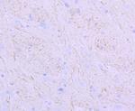 NEFM Antibody in Immunohistochemistry (Paraffin) (IHC (P))