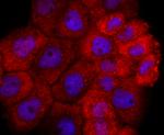 TIA-1 Antibody in Immunocytochemistry (ICC/IF)