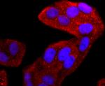 TIA-1 Antibody in Immunocytochemistry (ICC/IF)