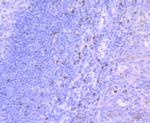 TIA-1 Antibody in Immunohistochemistry (Paraffin) (IHC (P))