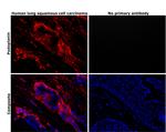 Podoplanin Antibody in Immunohistochemistry (Paraffin) (IHC (P))