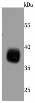 Podoplanin Antibody in Western Blot (WB)