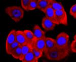 FGFR3 Antibody in Immunocytochemistry (ICC/IF)