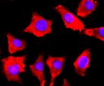 FGFR3 Antibody in Immunocytochemistry (ICC/IF)