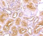 FGFR3 Antibody in Immunohistochemistry (Paraffin) (IHC (P))