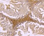 FGFR3 Antibody in Immunohistochemistry (Paraffin) (IHC (P))