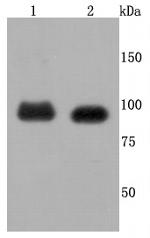 FGFR3 Antibody in Western Blot (WB)