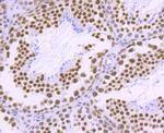 PABPN1 Antibody in Immunohistochemistry (Paraffin) (IHC (P))