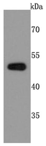 PABPN1 Antibody in Western Blot (WB)