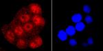 TDP-43 Antibody in Immunocytochemistry (ICC/IF)