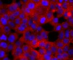 RAC1/RAC2/RAC3 Antibody in Immunocytochemistry (ICC/IF)