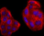 RAC1/RAC2/RAC3 Antibody in Immunocytochemistry (ICC/IF)