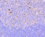 RAC1/RAC2/RAC3 Antibody in Immunohistochemistry (Paraffin) (IHC (P))