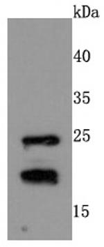 RAC1/RAC2/RAC3 Antibody in Western Blot (WB)