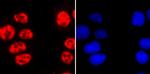 Phospho-RNA pol II CTD (Ser2) Antibody in Immunocytochemistry (ICC/IF)