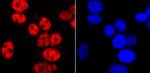 Phospho-RNA pol II CTD (Ser2) Antibody in Immunocytochemistry (ICC/IF)