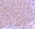 CTCF Antibody in Immunohistochemistry (Paraffin) (IHC (P))