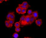 BID Antibody in Immunocytochemistry (ICC/IF)