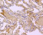 BID Antibody in Immunohistochemistry (Paraffin) (IHC (P))