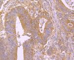 BID Antibody in Immunohistochemistry (Paraffin) (IHC (P))