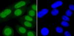 Ku70 Antibody in Immunocytochemistry (ICC/IF)