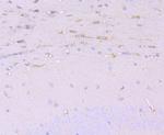 Cathepsin B Antibody in Immunohistochemistry (Paraffin) (IHC (P))