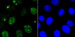 53BP1 Antibody in Immunocytochemistry (ICC/IF)