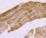 MUC2 Antibody in Immunohistochemistry (Paraffin) (IHC (P))