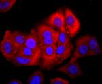 NFATC2 Antibody in Immunocytochemistry (ICC/IF)