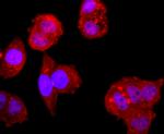 NFATC2 Antibody in Immunocytochemistry (ICC/IF)