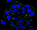 PRKAR2B Antibody in Immunocytochemistry (ICC/IF)